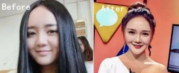 混血女明星鼻子_娱乐圈整容美女_美女整容前后对比